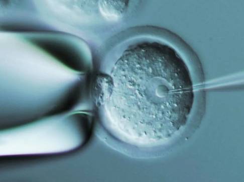 试管移植也会出现宫外孕，移植后宫外孕应该怎样进行治疗呢？